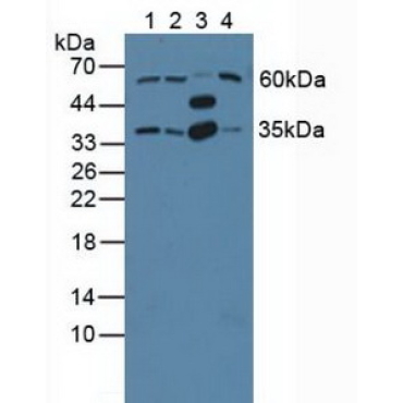 G Protein Beta 2 (GNb2) Human Polyclonal Antibody