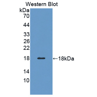 Profilin 3 (PFN3) Human Polyclonal Antibody