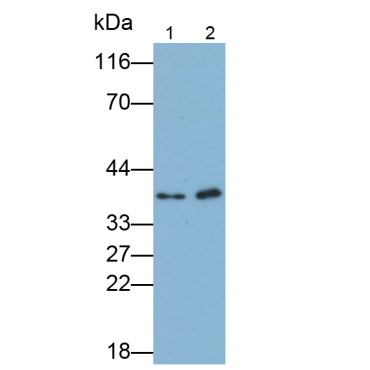 Wilms Tumor Protein (WT1) Human Polyclonal Antibody