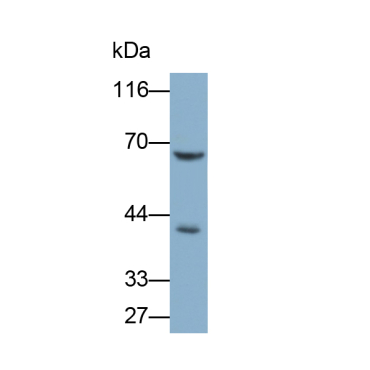 Ubiquitin Specific Peptidase 14 (USP14) Human Polyclonal Antibody