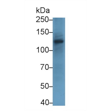 Ubiquitin Specific Peptidase 8 (USP8) Human Polyclonal Antibody
