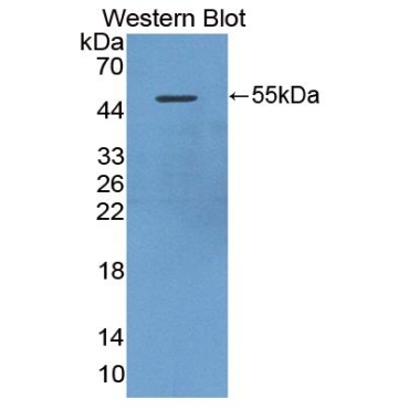 Death Associated Protein Kinase 3 (DAPK3) Mouse Polyclonal Antibody