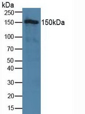 Tight Junction Protein 2 (TJP2) Human Polyclonal Antibody