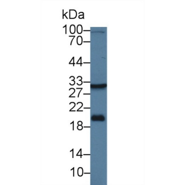 17-Beta-Hydroxysteroid Dehydrogenase Type 12 (HSD17b12) Human Polyclonal Antibody