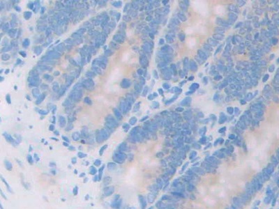 17-Beta-Hydroxysteroid Dehydrogenase Type 12 (HSD17b12) Rat Polyclonal Antibody