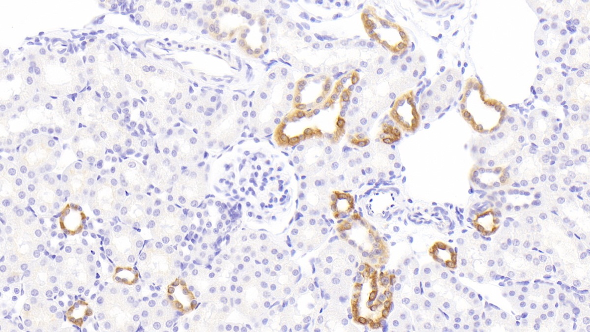 11-Beta-Hydroxysteroid Dehydrogenase Type 2 (HSD11b2) Rat Polyclonal Antibody