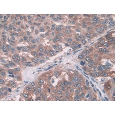Fucosyltransferase 6 (FUT6) Human Polyclonal Antibody