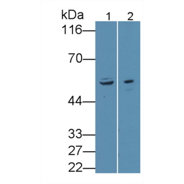 Anthrax Toxin Receptor 2 (ANTXR2) Human Polyclonal Antibody