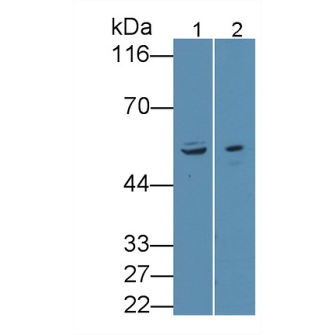Anthrax Toxin Receptor 2 (ANTXR2) Human Polyclonal Antibody