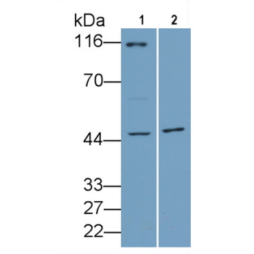 Aurora Kinase A (AURKA) Human Polyclonal Antibody