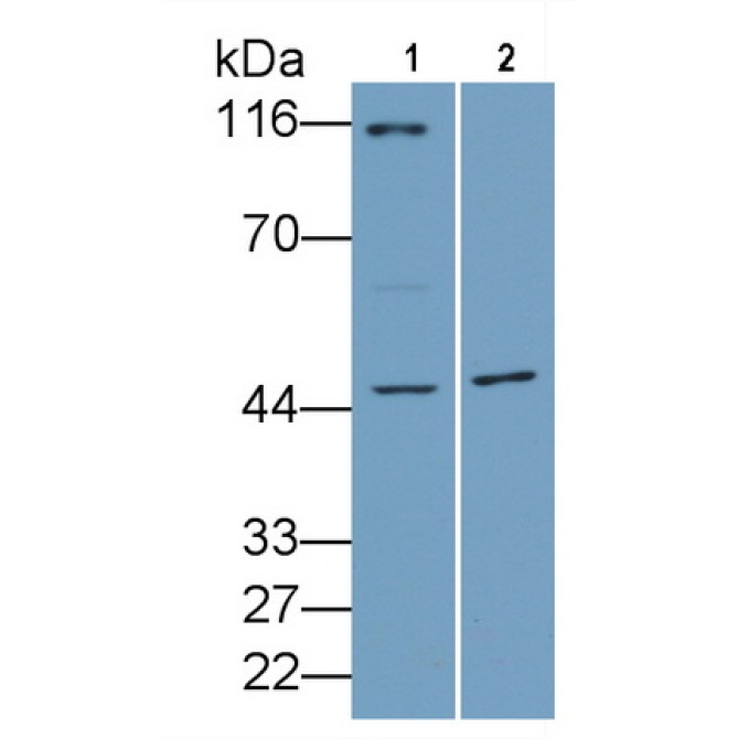 Aurora Kinase A (AURKA) Human Polyclonal Antibody