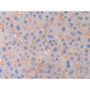 Ectonucleotide Pyrophosphatase/Phosphodiesterase 1 (ENPP1) Human Polyclonal Antibody