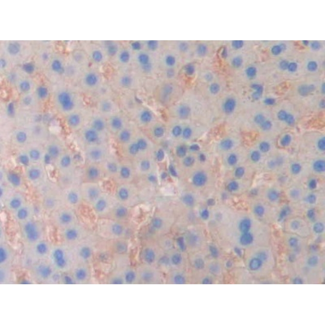 Ectonucleotide Pyrophosphatase/Phosphodiesterase 1 (ENPP1) Human Polyclonal Antibody