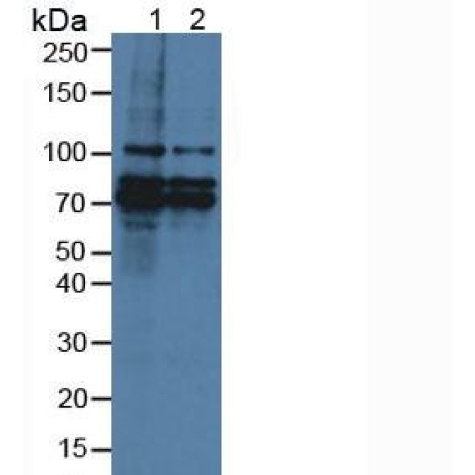 Breast Carcinoma Amplified Sequence 3 (BCAS3) Human Polyclonal Antibody