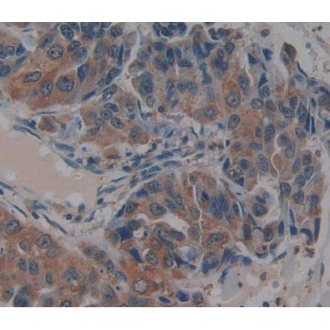 Bcl2 Associated Athanogene 5 (BAG5) Human Polyclonal Antibody