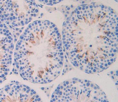 Bcl2 Associated Athanogene 5 (BAG5) Mouse Polyclonal Antibody