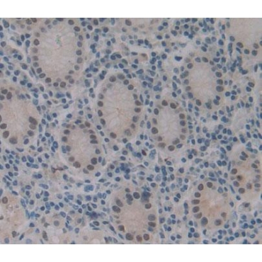 Bcl2 Associated Athanogene 1 (BAG1) Human Polyclonal Antibody