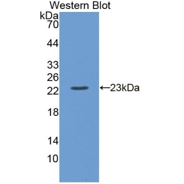 Calcium Channel, Voltage Dependent, L-Type, Alpha 1S Subunit (CACNa1S) Mouse Polyclonal Antibody