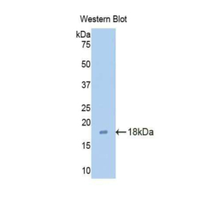 Claudin 3 (CLDN3) Mouse Polyclonal Antibody