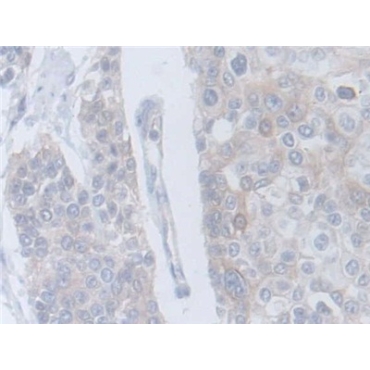 Cytokine Receptor Like Factor 1 (CRLF1) Human Polyclonal Antibody