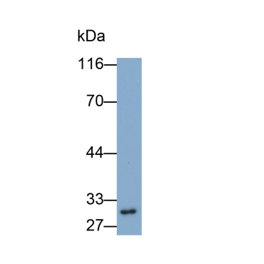 Chloride Intracellular Channel Protein 4 (CLIC4) Human Polyclonal Antibody