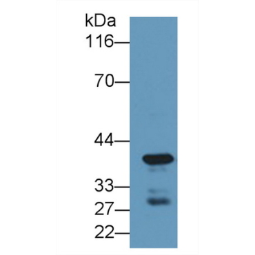 Carboxypeptidase A4 (CPA4) Human Polyclonal Antibody