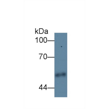 Carboxypeptidase E (CPE) Human Polyclonal Antibody