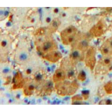 Carboxypeptidase E (CPE) Human Polyclonal Antibody