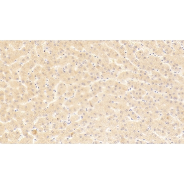 Carboxypeptidase N2 (CPN2) Human Polyclonal Antibody