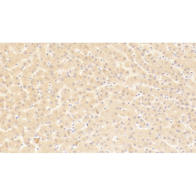 Carboxypeptidase N2 (CPN2) Human Polyclonal Antibody