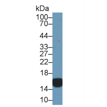 Cellular Retinoic Acid Binding Protein 2 (CRABP2) Human Polyclonal Antibody