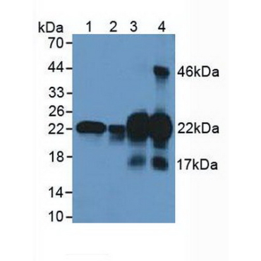 Cysteine And Glycine Rich Protein 1 (CSRP1) Human Polyclonal Antibody