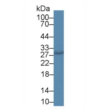 Cysteine Rich Secretory Protein 3 (CRISP3) Human Polyclonal Antibody
