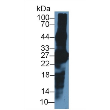 Crystallin Beta A1 (CRYbA1) Mouse Polyclonal Antibody