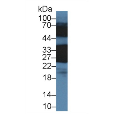 Crystallin Beta B1 (CRYbB1) Mouse Polyclonal Antibody