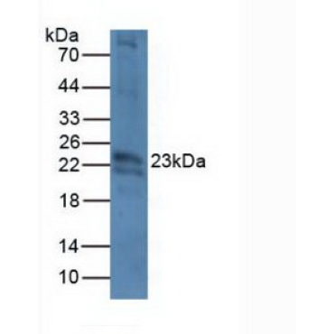 Crystallin Beta B2 (CRYbB2) Mouse Polyclonal Antibody
