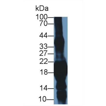 Crystallin Gamma S (CRYgS) Mouse Polyclonal Antibody