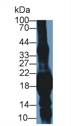 Crystallin Gamma S (CRYgS) Mouse Polyclonal Antibody