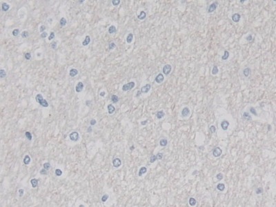Cullin 9 (CUL9) Human Polyclonal Antibody