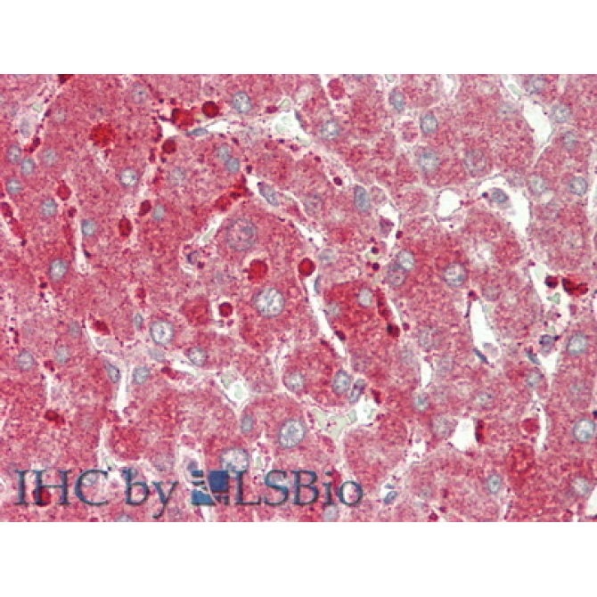 Carnitine Palmitoyltransferase 1A, Liver (CPT1A) Human Polyclonal Antibody
