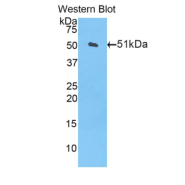 Carnitine Palmitoyltransferase 1A, Liver (CPT1A) Mouse Polyclonal Antibody