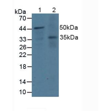 Docking Protein 3 (DOK3) Human Polyclonal Antibody