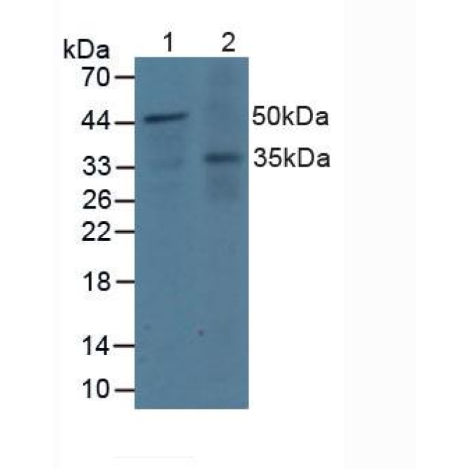 Docking Protein 3 (DOK3) Human Polyclonal Antibody