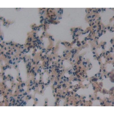 Docking Protein 3 (DOK3) Mouse Polyclonal Antibody