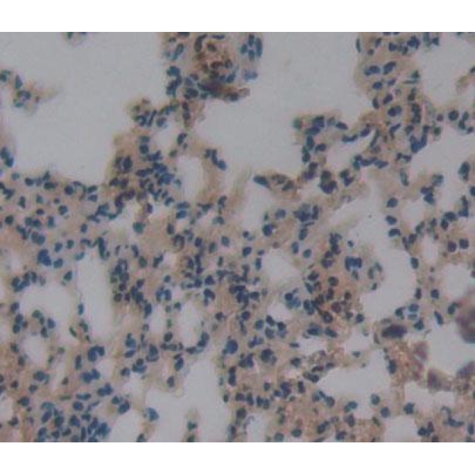 Docking Protein 3 (DOK3) Mouse Polyclonal Antibody