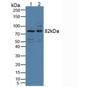 Doublecortin Like Kinase 1 (DCLK1) Human Polyclonal Antibody