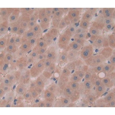 Calcium Homeostasis Endoplasmic Reticulum Protein (CHERP) Human Polyclonal Antibody