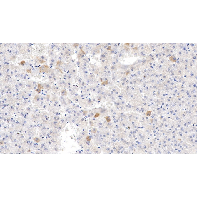 Endothelin 2 (EDN2) Human Polyclonal Antibody