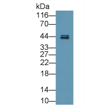 Fatty Acid Desaturase 2 (FADS2) Human Polyclonal Antibody