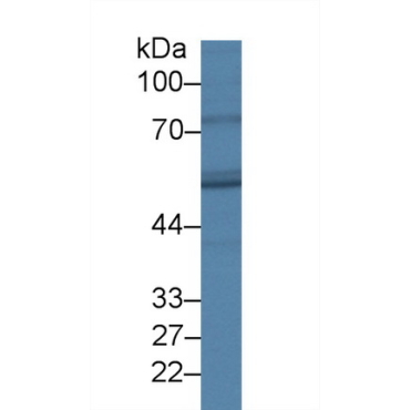 Fatty Acid Desaturase 3 (FADS3) Human Polyclonal Antibody